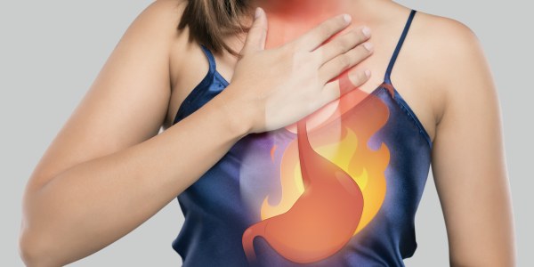 Debunking Acid Reflux