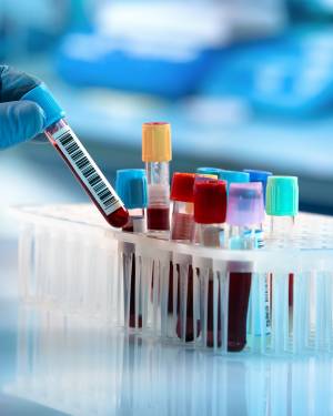 Lab Analysis Near Me in Rock Hill, SC